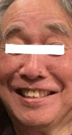 症例2